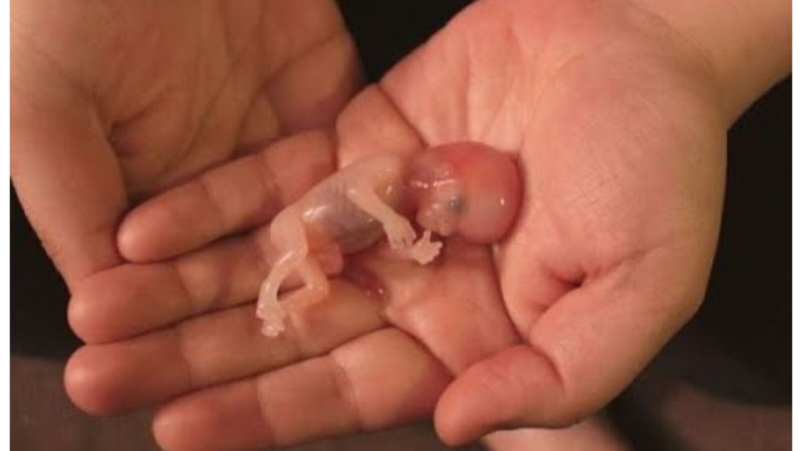 Vínculo entre anticonceptivos y aborto: Un debate en auge