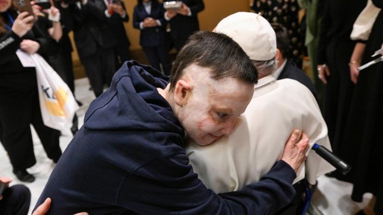 El Papa Francisco recibe por tercera vez a un niño ucraniano víctima de un ataque ruso