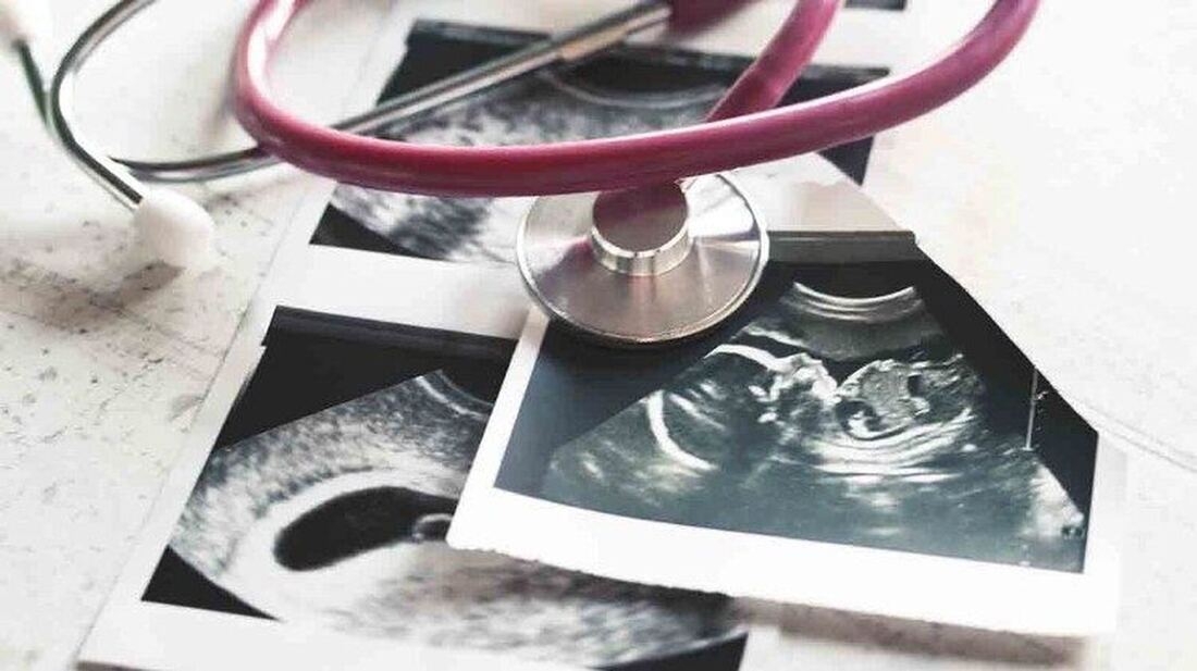Legisladores de EE.UU. impulsan una ley para prohibir el aborto por desmembramiento