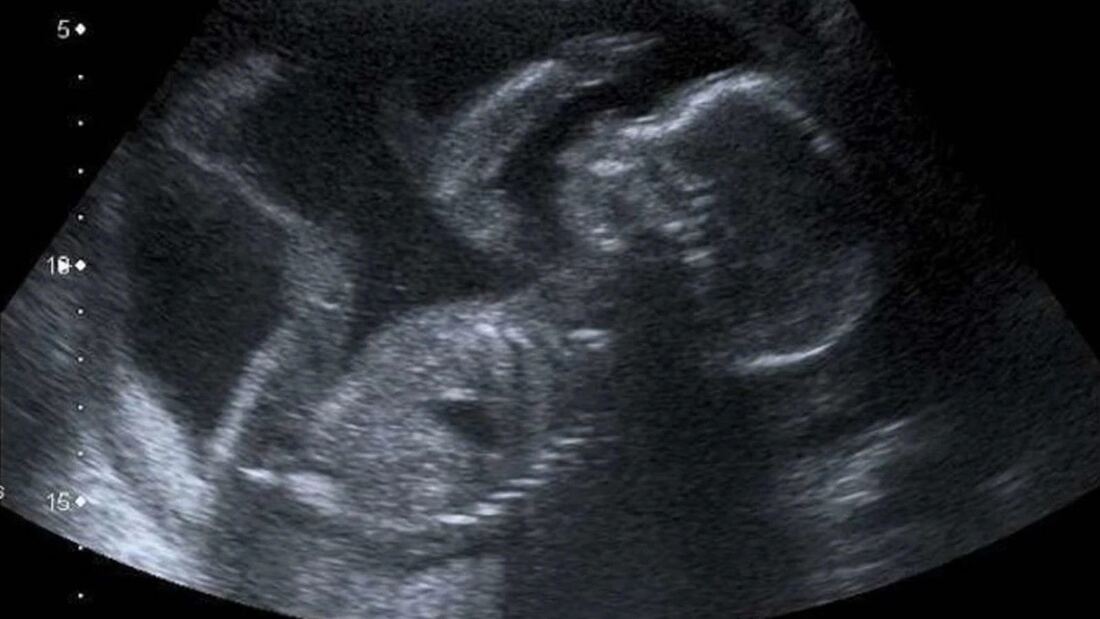 La financiación del aborto centra el debate en la Cámara de Representantes de Estados Unidos